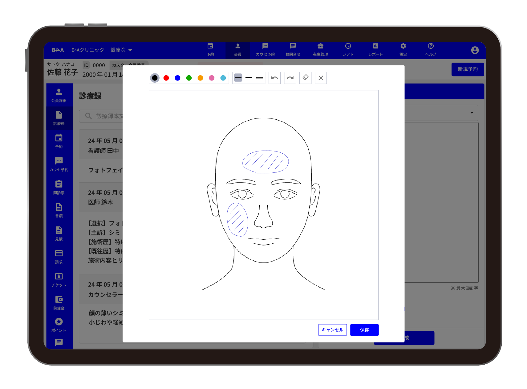 カルテ画面のイメージ