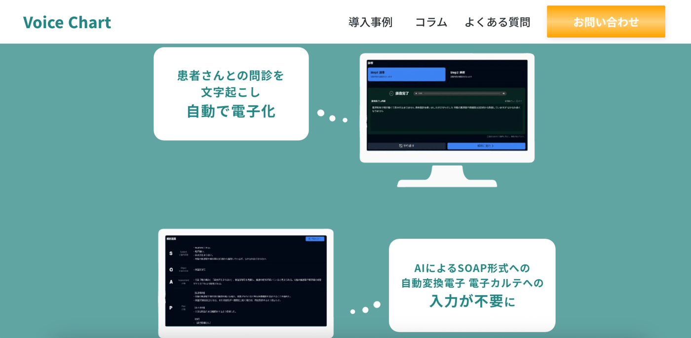 Voice ChartのUI画面
